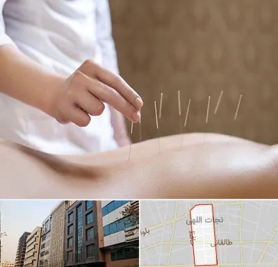 درای نیدلینگ در نجات اللهی