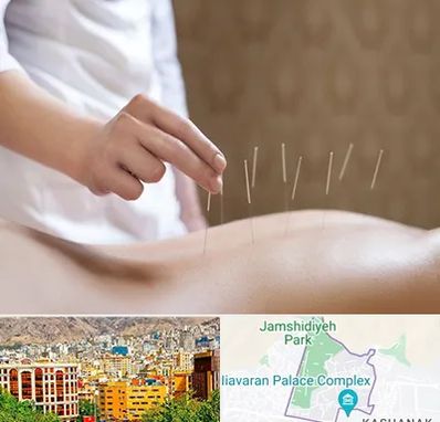 درای نیدلینگ در نیاوران