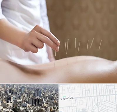 درای نیدلینگ در جیحون