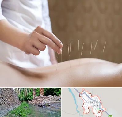 درای نیدلینگ در سراوان