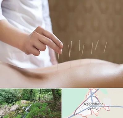 درای نیدلینگ در آزادشهر
