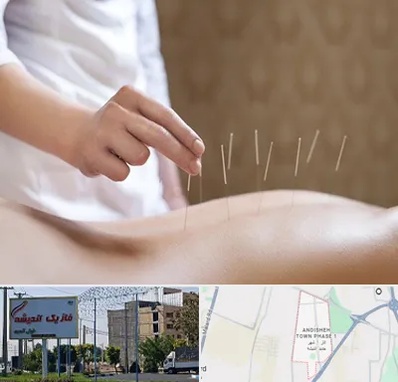 درای نیدلینگ در فاز یک اندیشه