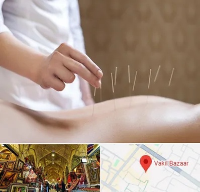 درای نیدلینگ در بازار وکیل شیراز