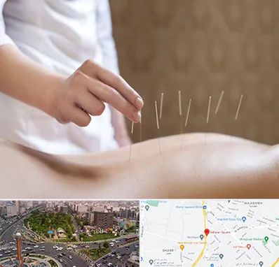 درای نیدلینگ در سبلان 