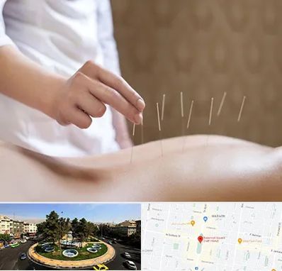 درای نیدلینگ در هفت حوض 