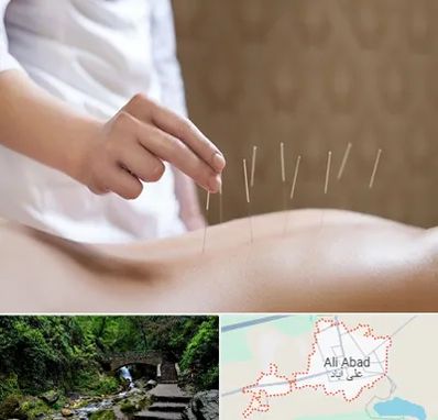 درای نیدلینگ در علی آباد کتول