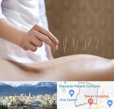 درای نیدلینگ در آجودانیه 