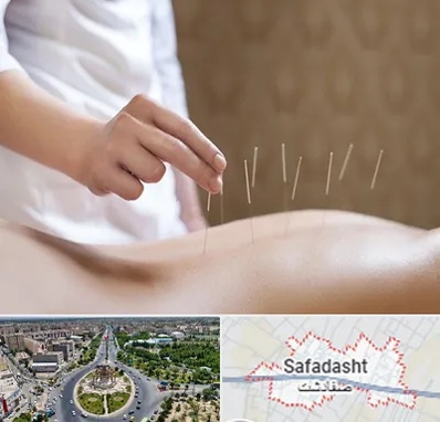 درای نیدلینگ در صفادشت