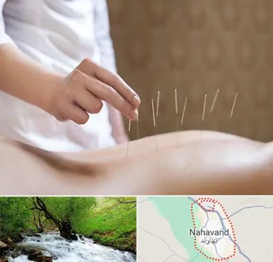 درای نیدلینگ در نهاوند