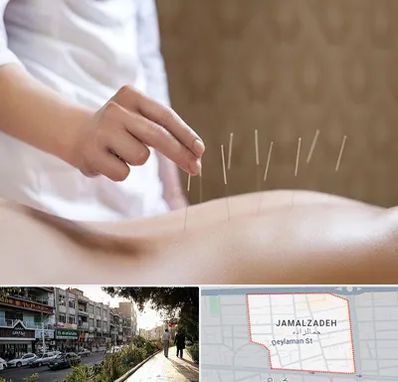 درای نیدلینگ در خیابان جمالزاده