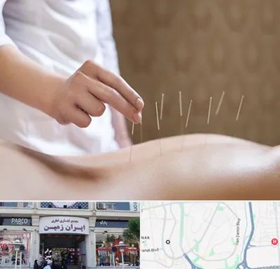 درای نیدلینگ در ایران زمین