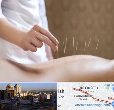 درای نیدلینگ در فرمانیه 