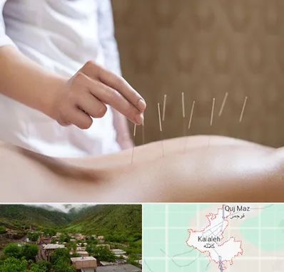 درای نیدلینگ در کلاله