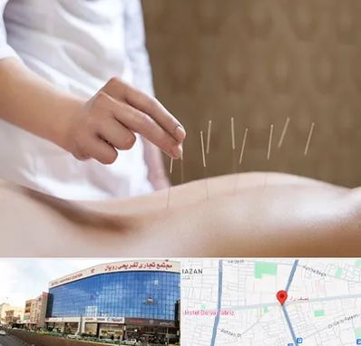 درای نیدلینگ در نصف راه تبریز