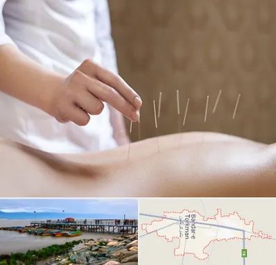 درای نیدلینگ در بندر ترکمن