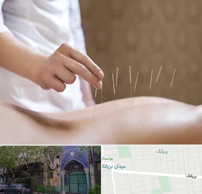 درای نیدلینگ در بریانک