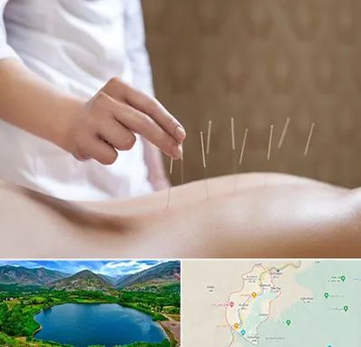 درای نیدلینگ در رودبار