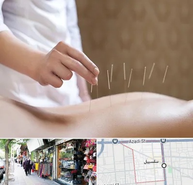 درای نیدلینگ در سلسبیل