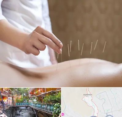 درای نیدلینگ در درکه