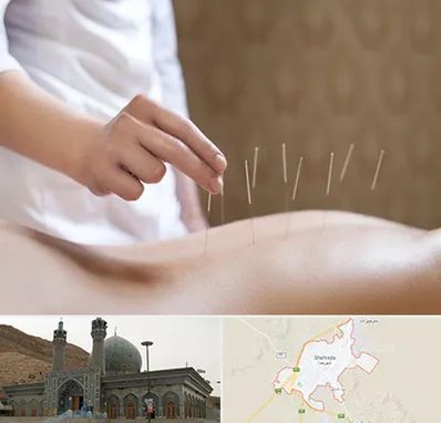 درای نیدلینگ در شهرضا