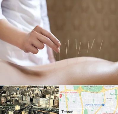 درای نیدلینگ در مرزداران 