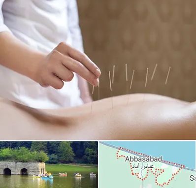 درای نیدلینگ در عباس آباد