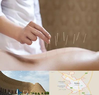 درای نیدلینگ در سیرجان
