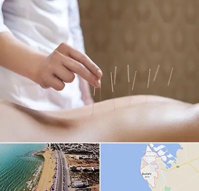 درای نیدلینگ در بوشهر