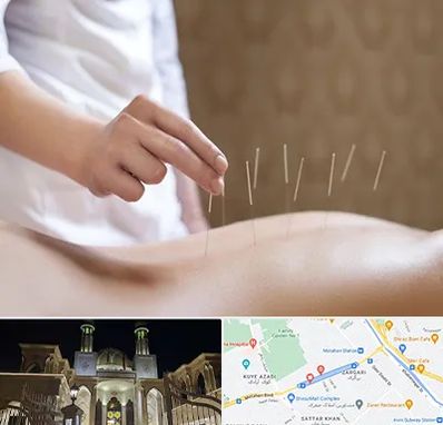 درای نیدلینگ در زرگری شیراز 