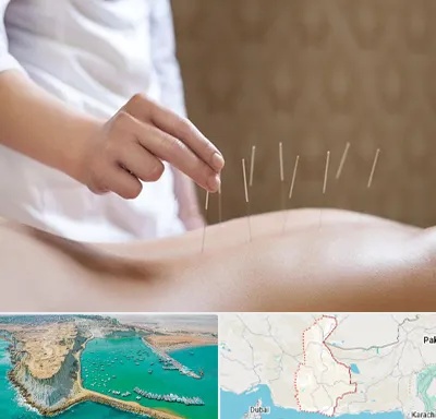 درای نیدلینگ در سیستان و بلوچستان