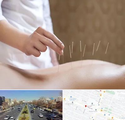 درای نیدلینگ در بلوار معلم مشهد 