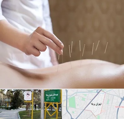 درای نیدلینگ در تهران ویلا
