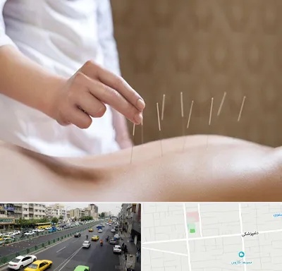 درای نیدلینگ در خیابان دامپزشکی