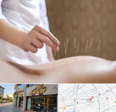 درای نیدلینگ در عطاران قم