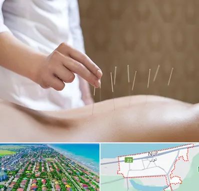 درای نیدلینگ در نور