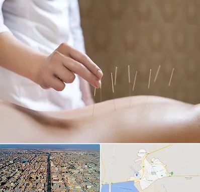 درای نیدلینگ در بندر ماهشهر