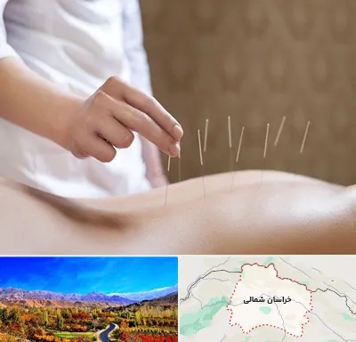 درای نیدلینگ در خراسان شمالی
