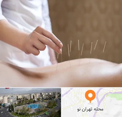 درای نیدلینگ در تهران نو