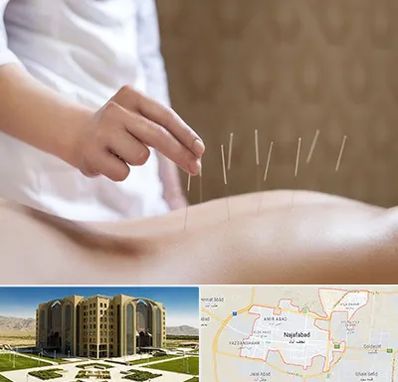 درای نیدلینگ در نجف آباد