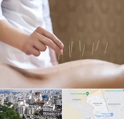 درای نیدلینگ در ولنجک 