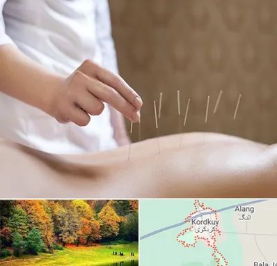 درای نیدلینگ در کردکوی
