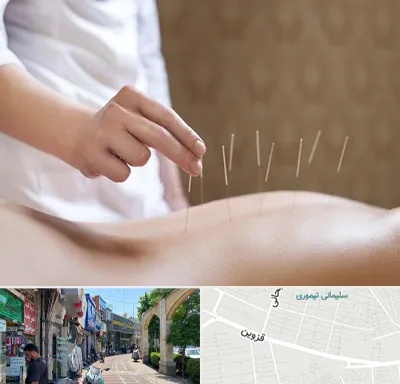 درای نیدلینگ در خیابان قزوین