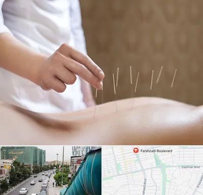 درای نیدلینگ در بلوار فرحزادی