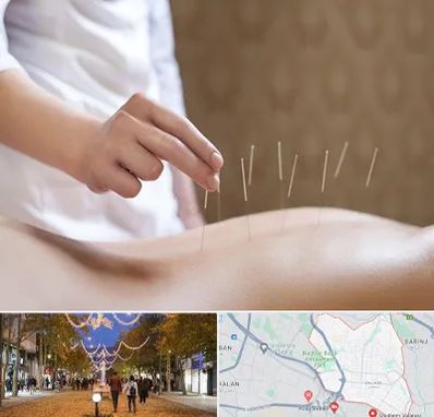 درای نیدلینگ در ولیعصر ارومیه