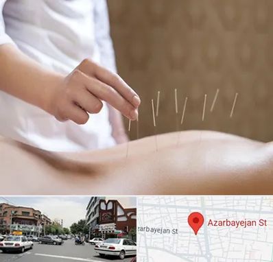 درای نیدلینگ در خیابان آذربایجان