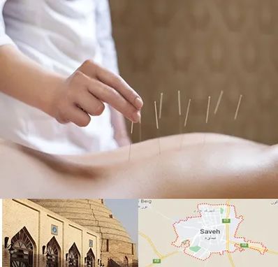 درای نیدلینگ در ساوه
