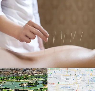 درای نیدلینگ در منطقه 9 تهران 