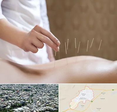 درای نیدلینگ در شاهرود