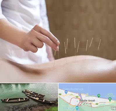 درای نیدلینگ در بندر انزلی