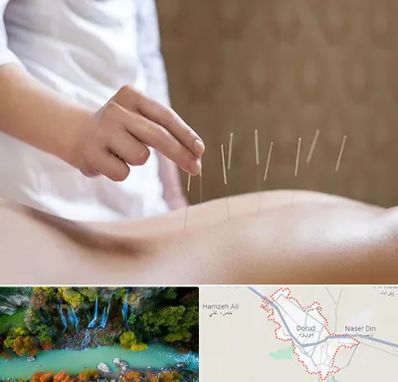 درای نیدلینگ در دورود